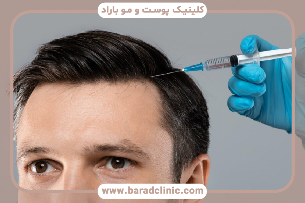 مزایای فیلر مو چیست و چگونه انجام می‌شود؟