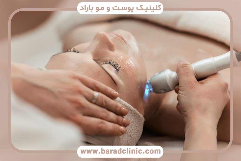 Skin Rejuvenation with Fractional RF
