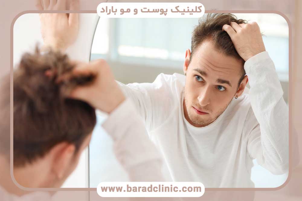 The main differences between hair transplantation and other hair loss treatments