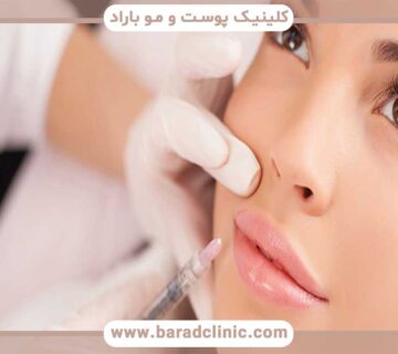 Dermal fillers