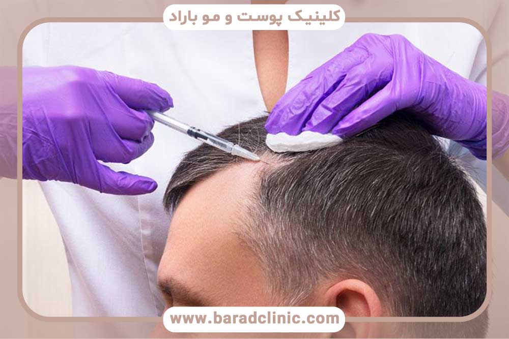 Comparing hair transplantation with PRP and mesotherapy