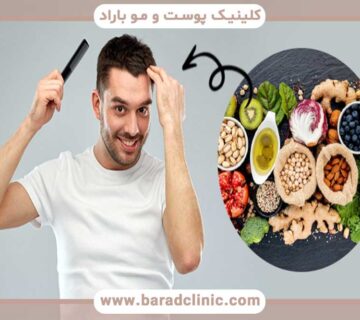 The impact of lifestyle and nutrition on the success of hair transplantation