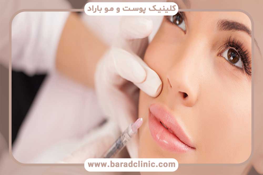 Dermal fillers