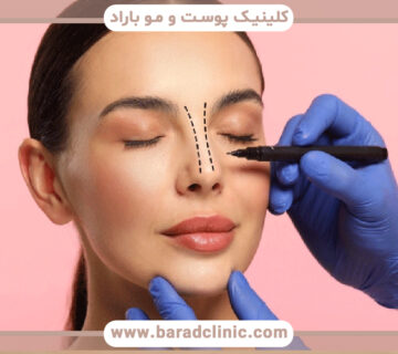 سن مناسب برای جراحی بینی