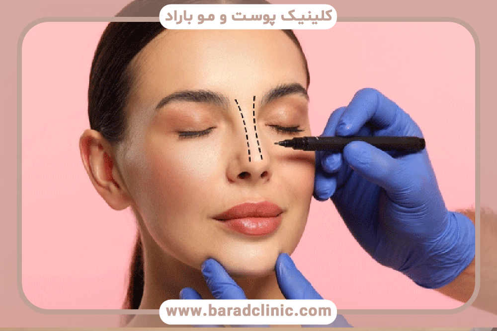 سن مناسب برای جراحی بینی