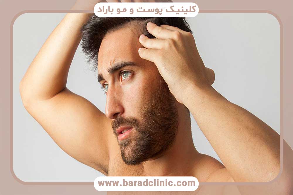 کاشت مو در نواحی جلو، فرق سر و شقیقه