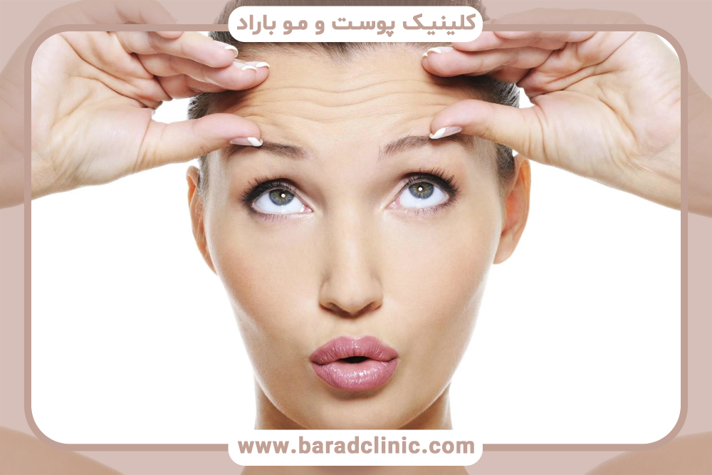 همه چیز درباره بوتاکس چشم گربه ای