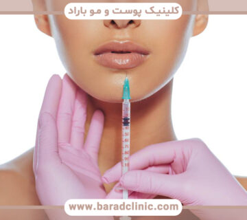 روش های فرم دهی و افزایش حجم لب ها