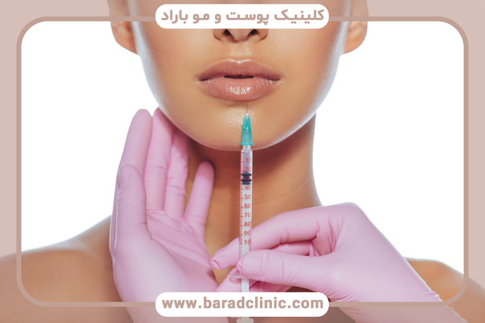 روش های فرم دهی و افزایش حجم لب ها