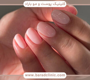 قارچ ناخن چیست؟ علائم، علل و راه درمان آن