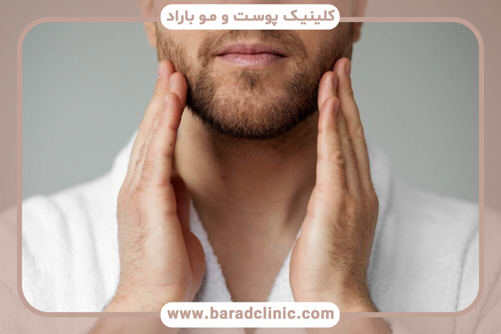 آیا کاشت ریش درد دارد؟ مزایا و معایب آن چیست