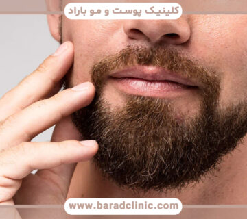 کاشت ریش برای نوجوانان و جوانان مناسب است؟