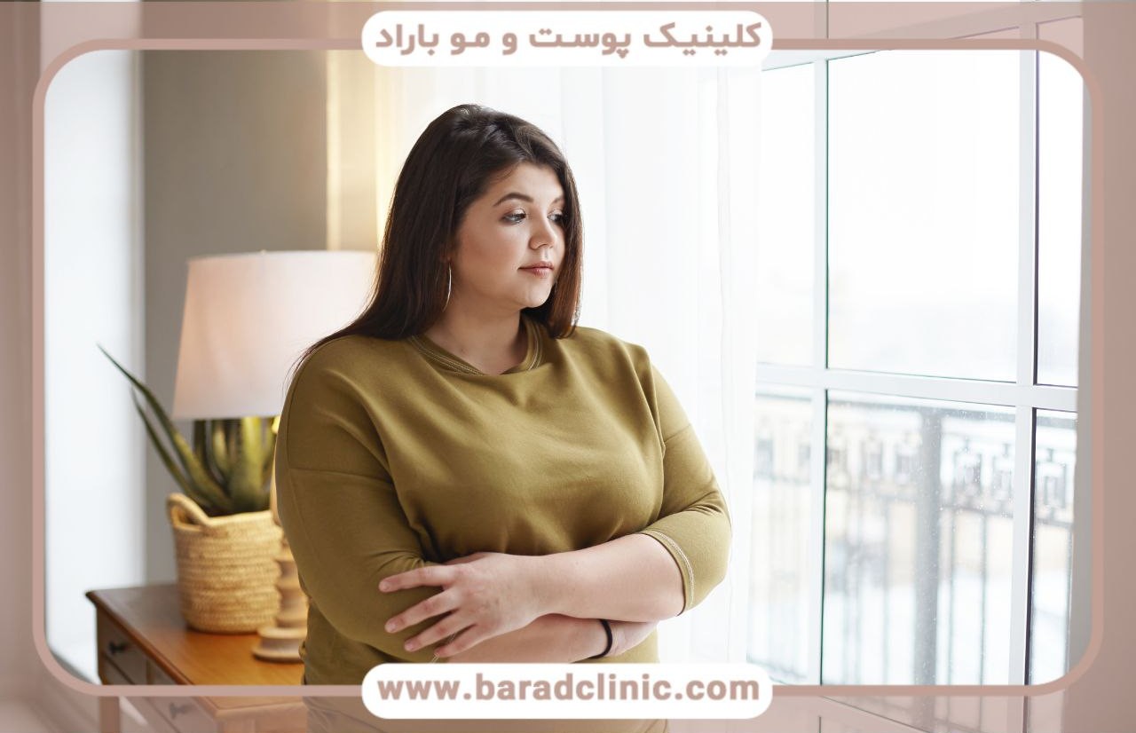 مکانیسم‌های پیکرتراشی