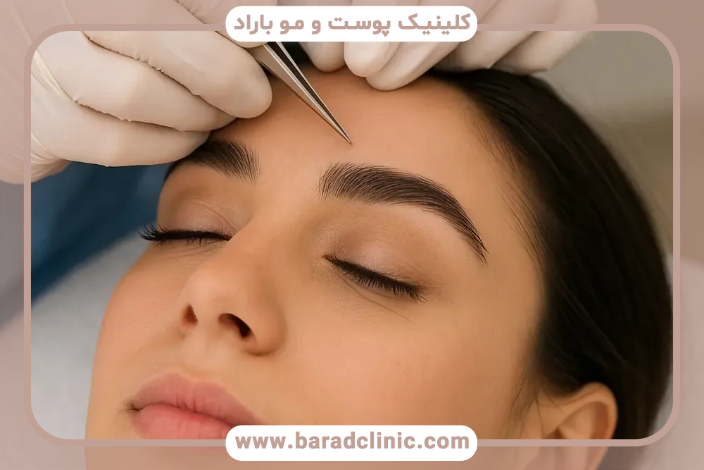 کاشت ابروی طبیعی