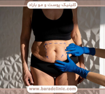 تحولات پیکرتراشی