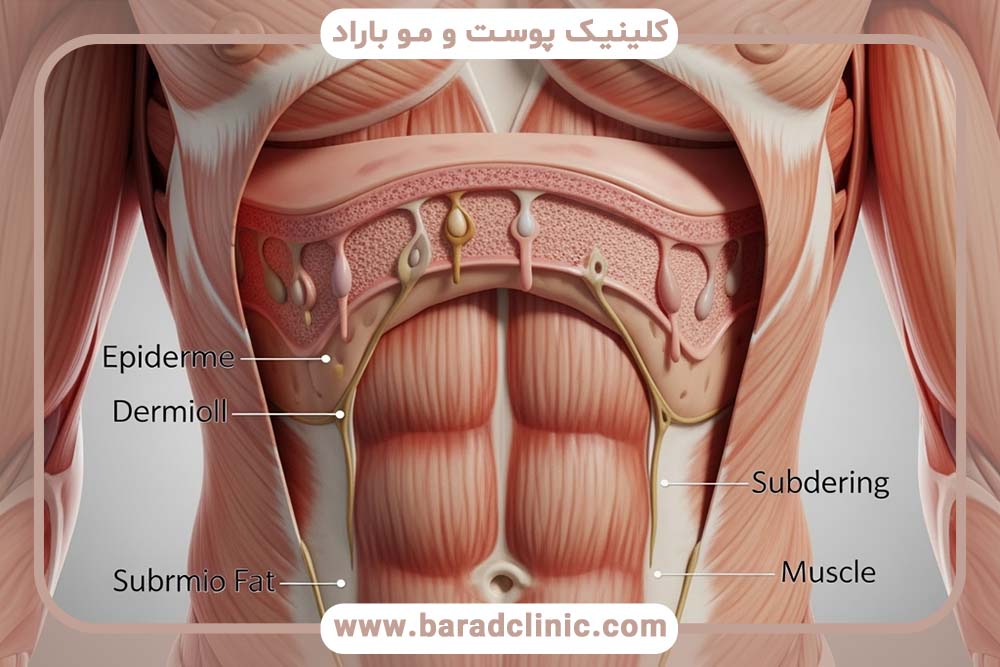 آناتومی پوست و عضلات در لیفت بدن