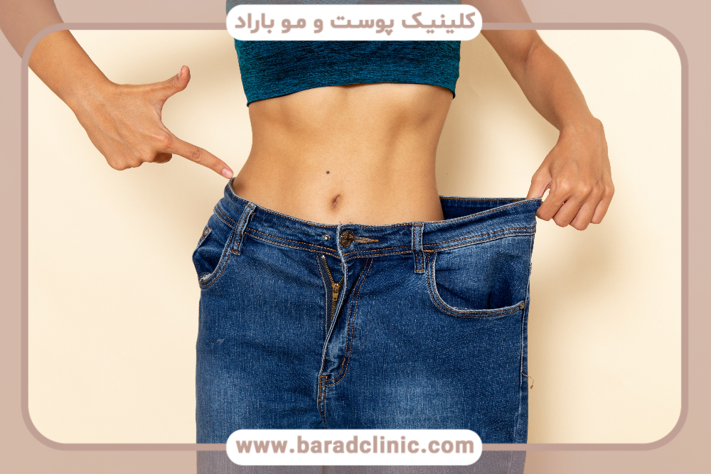 ابدومینوپلاستی 