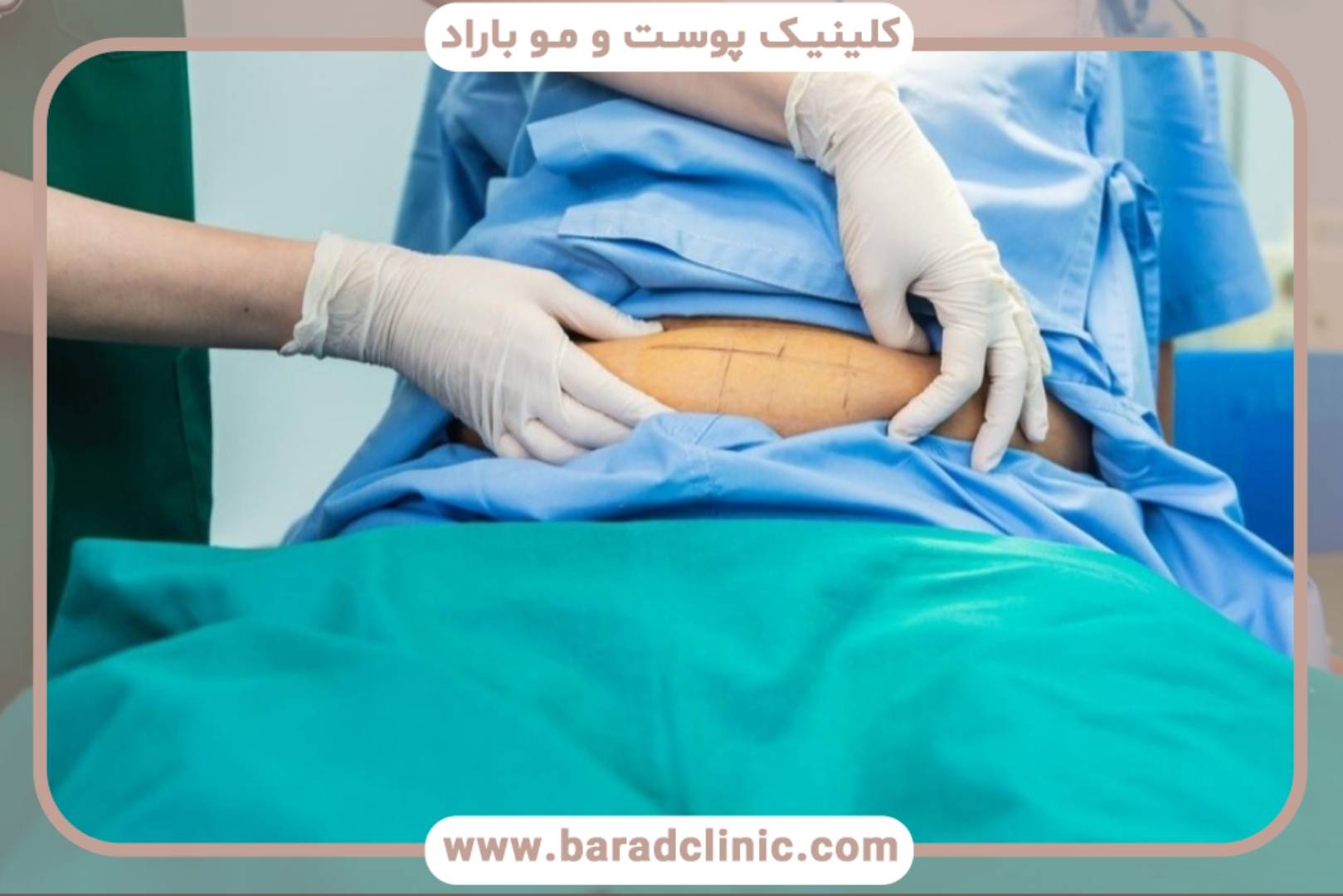 راه رفتن و حالت خوابیدن مناسب