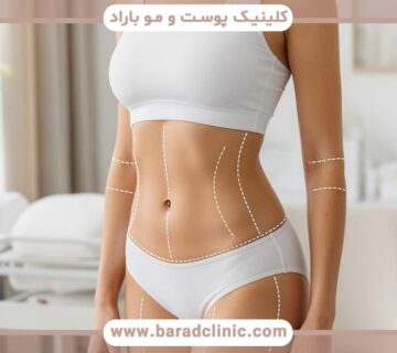 اصطلاحات تخصصی که باید درباره لیفت بدن بدانید
