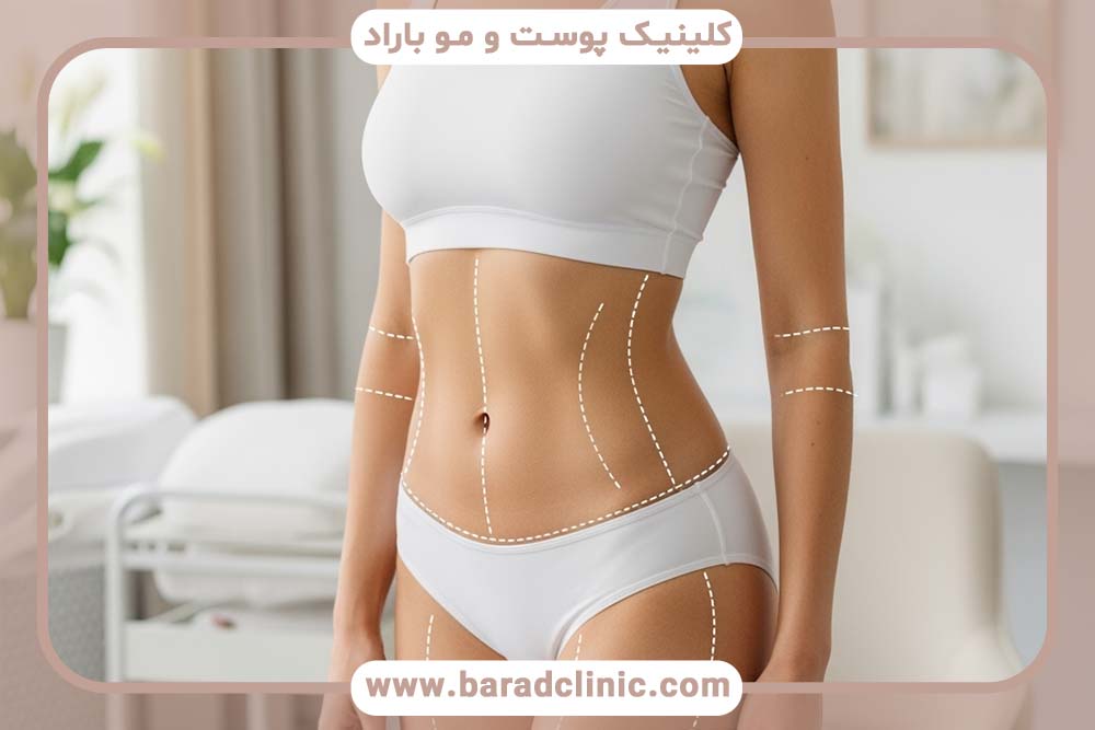 اصطلاحات تخصصی که باید درباره لیفت بدن بدانید