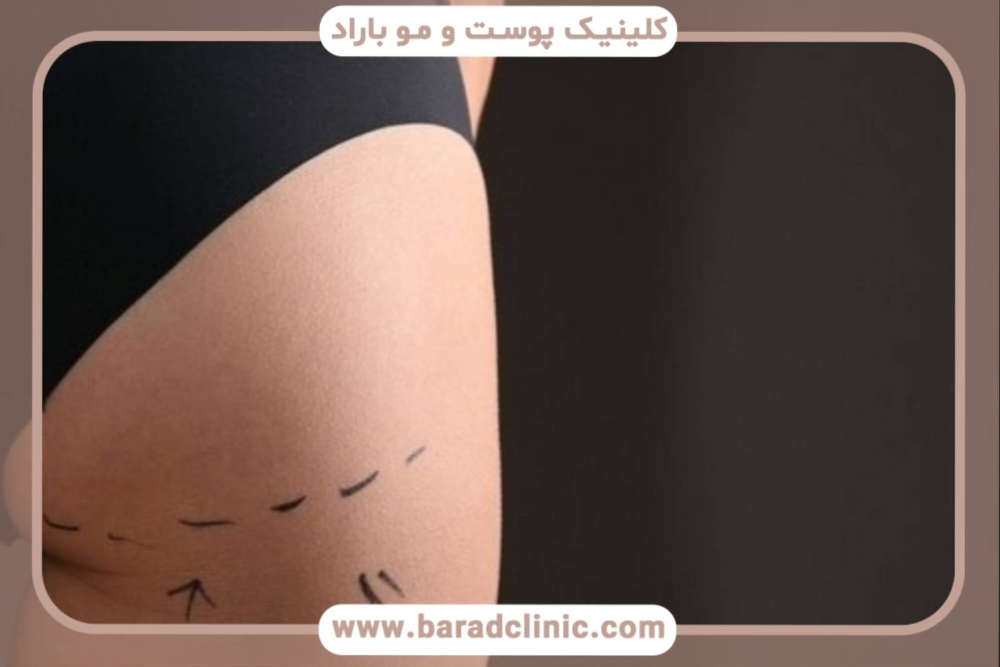 ترنسفر باسن