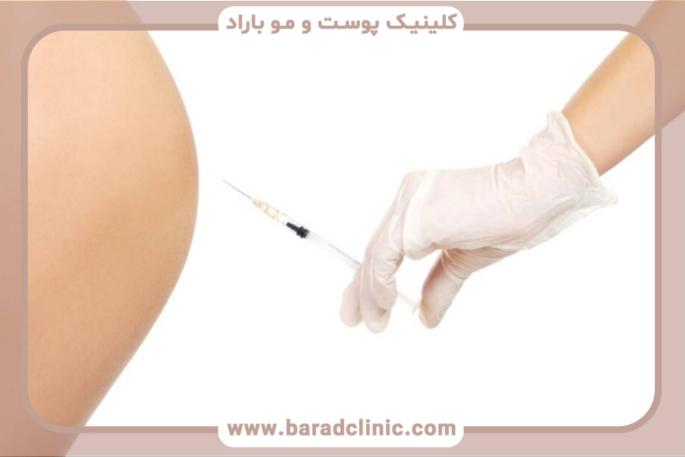 ترنسفر باسن