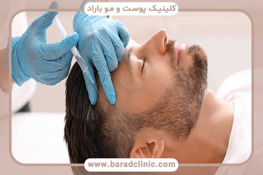 Hair transplantation with local anesthesia