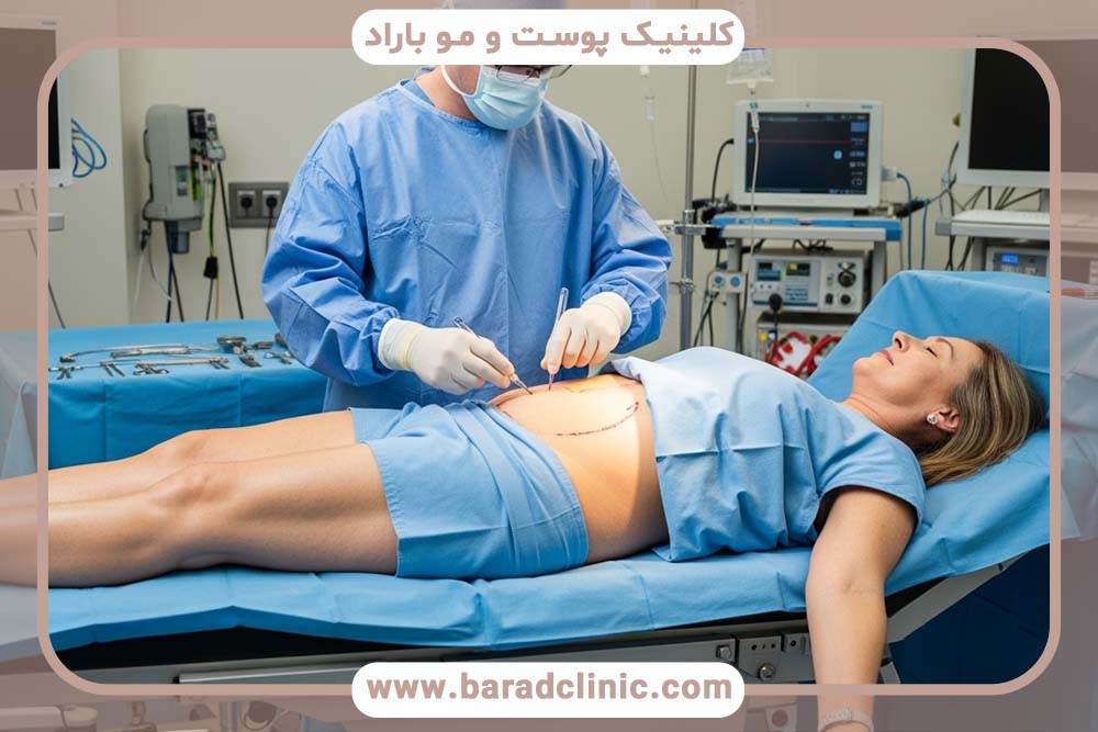 تکنیک‌های جدید بخیه در لیفت بدن