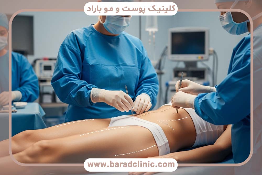 جدیدترین تکنیک‌های لیفت بدن در ۲۰۲۴