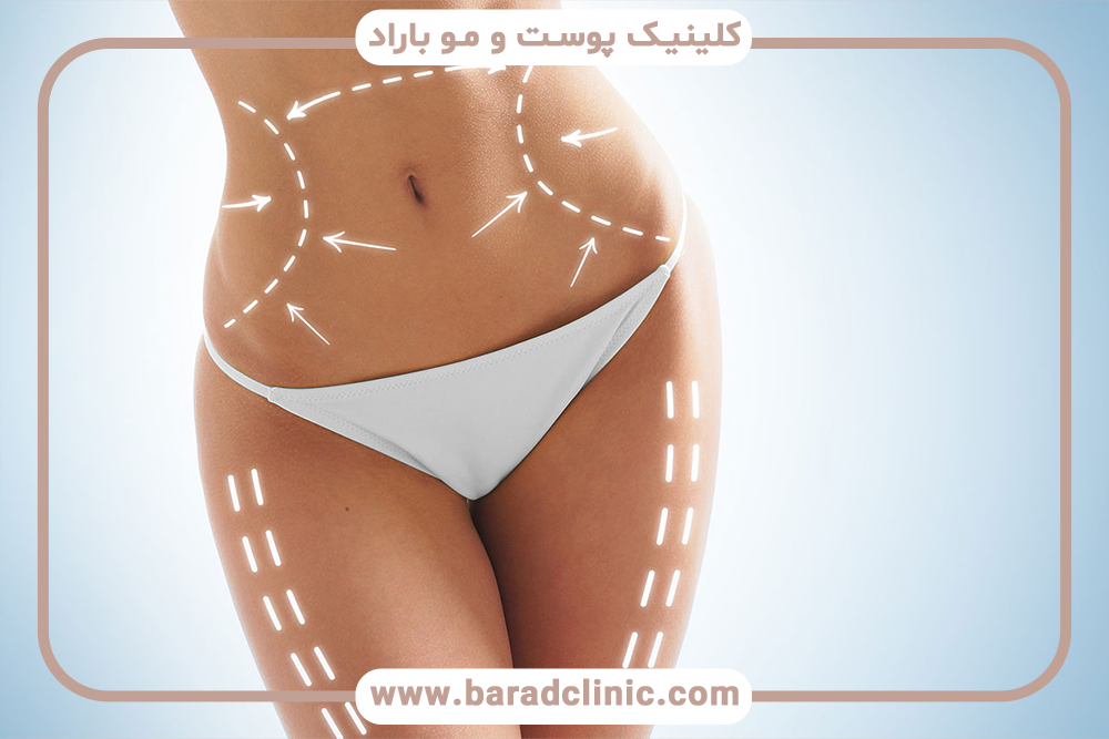 آزمایشات ضروری قبل از لیفت بدن