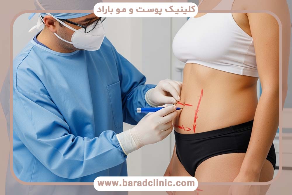 مقایسه لیفت بدن با روش‌های غیرجراحی