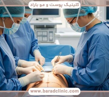 لیفت بدن برای بدنسازان