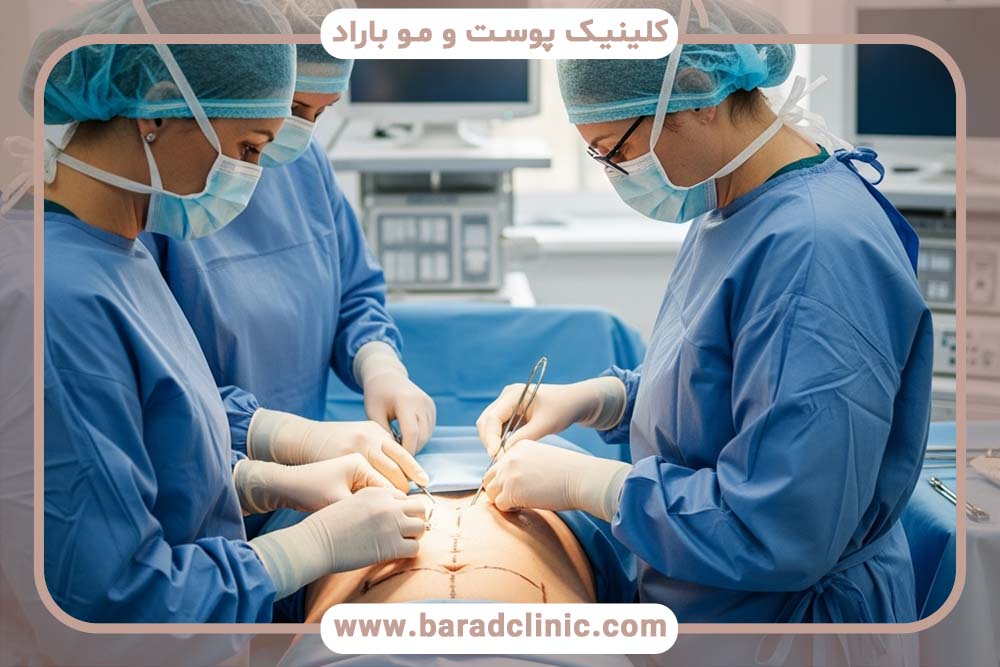 لیفت بدن برای بدنسازان