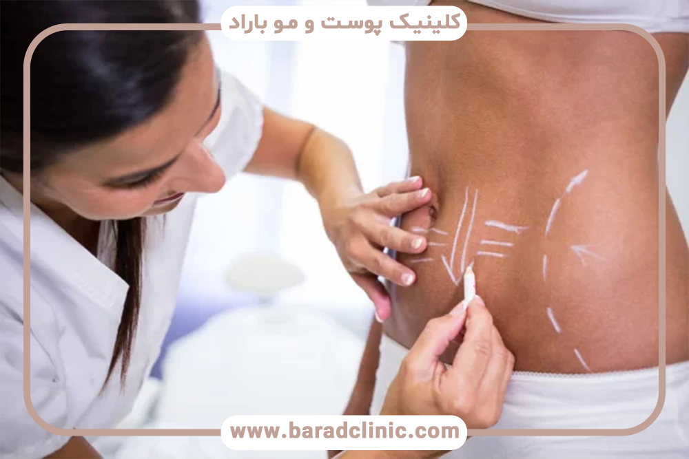 وسایل ضروری برای دوران نقاهت