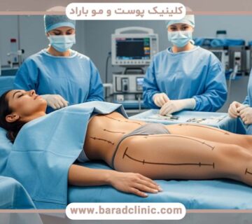 لیفت بدن مردانه و زنانه