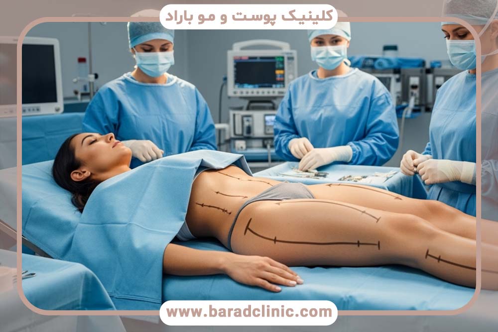 لیفت بدن مردانه و زنانه