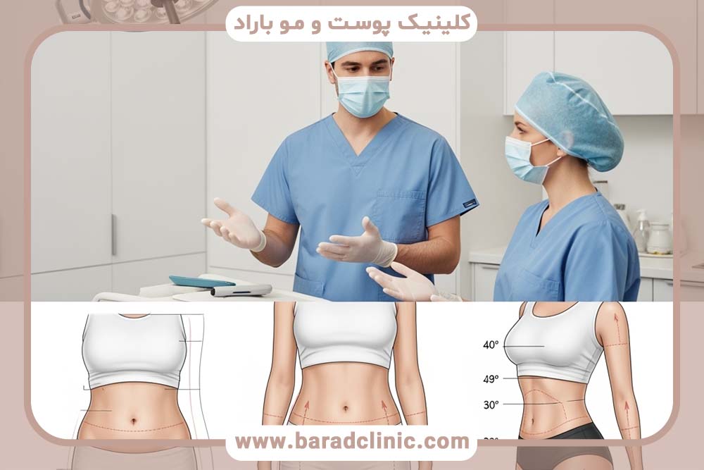 لیفت بدن همراه با لیپوساکشن