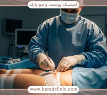 لیفت بدن ۳۶۰ درجه (Circumferential)