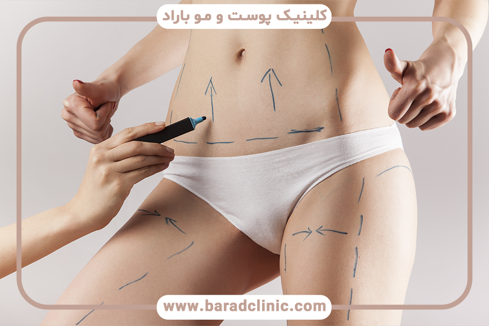 داروهای ممنوعه قبل از لیفت بدن