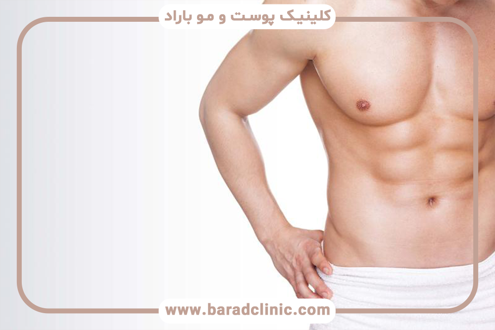 لیفت سینه در مردان و زنان