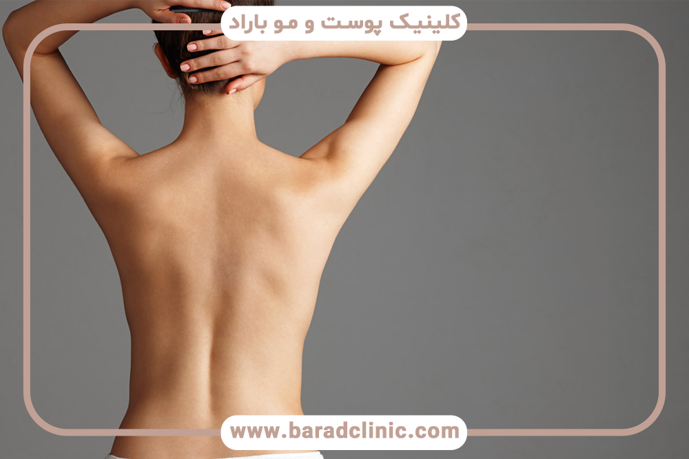 لیفت بدن برای اصلاح نامتقارنی