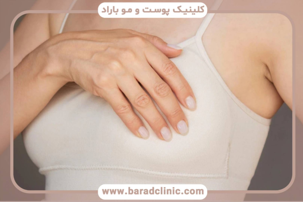 ماموپلاستی