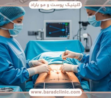 نقش ژنتیک در نتایج لیفت بدن