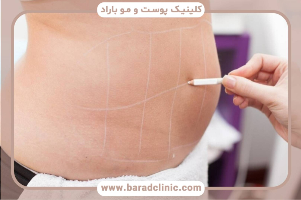 پیکرتراشی چیست؟