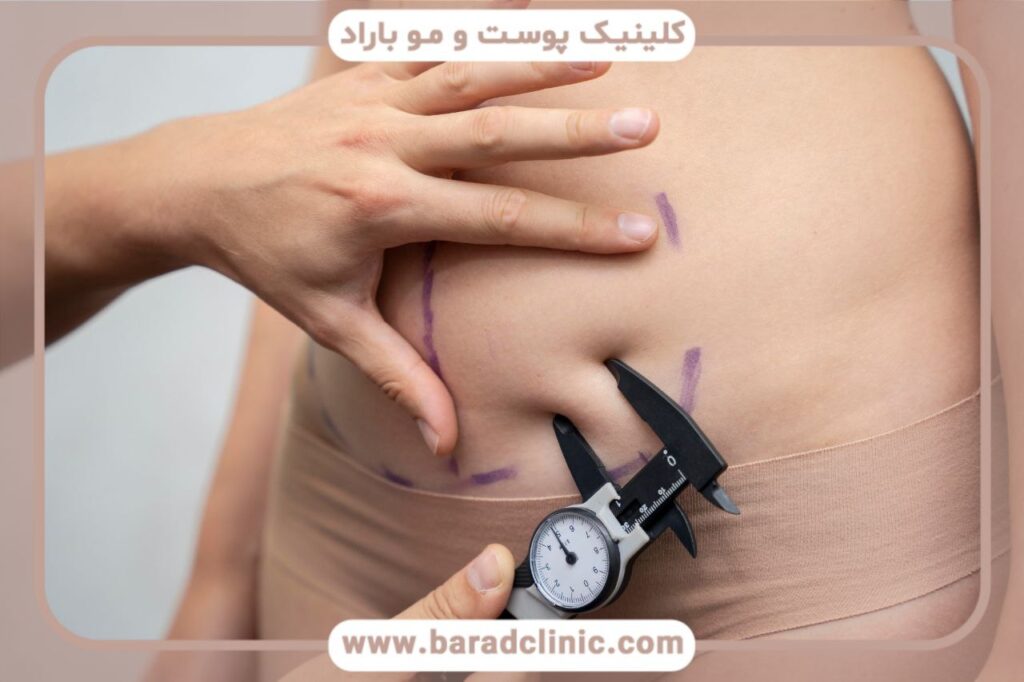 پیکرتراشی چیست و آیا جراحی زیبایی محسوب می‌شود