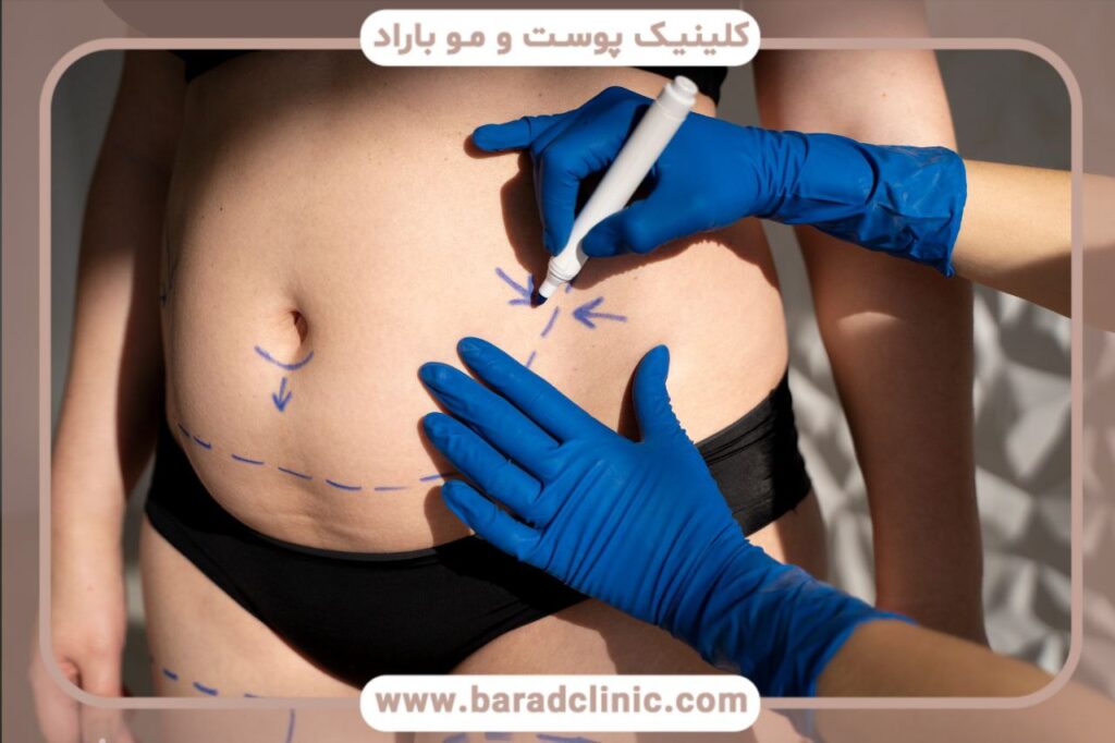 پیکرتراشی چیست و آیا جراحی زیبایی محسوب می‌شود