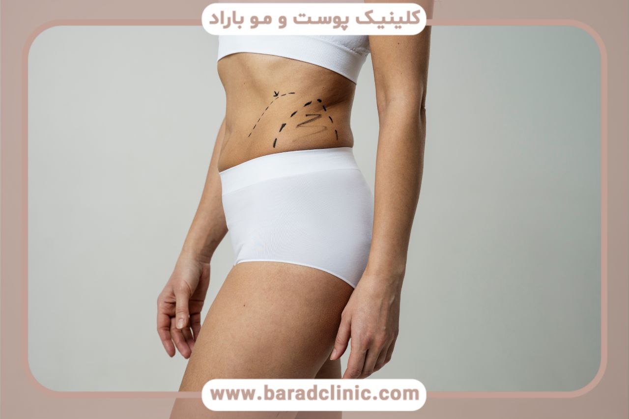 روش های پیکرتراشی