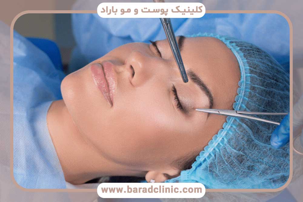 Postoperative care for blepharoplasty