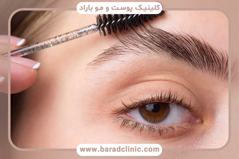 The best method for eyebrow transplantation