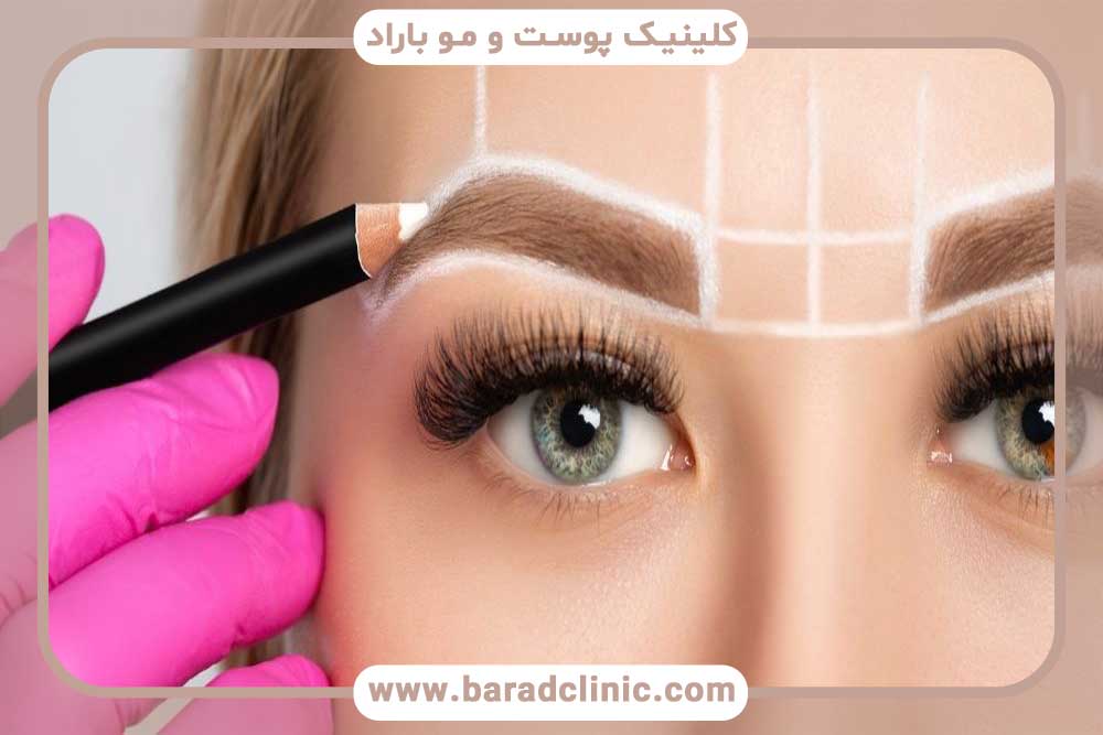 مراقبت‌های قبل و بعد کاشت ابرو